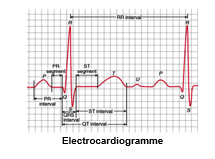 publications-electrocardiogramme